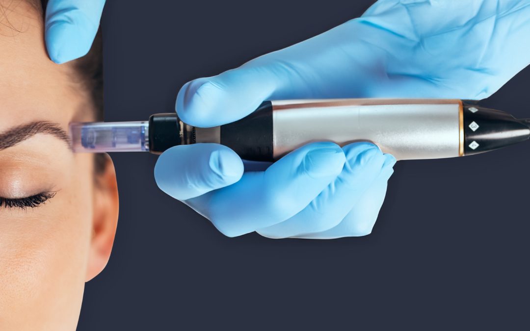 Tratamiento de mesoterapia facial en clínica estética de Santander y Valladolid, hidratando y revitalizando la piel para un rostro radiante.