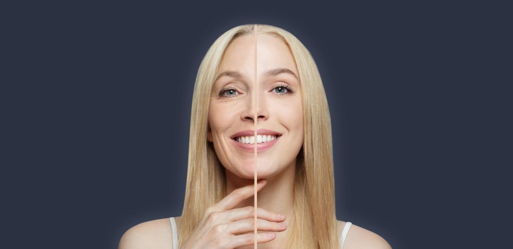 Tratamiento Full Face en clínica estética de Santander y Valladolid, combinando técnicas faciales para una transformación completa y resultados naturales.