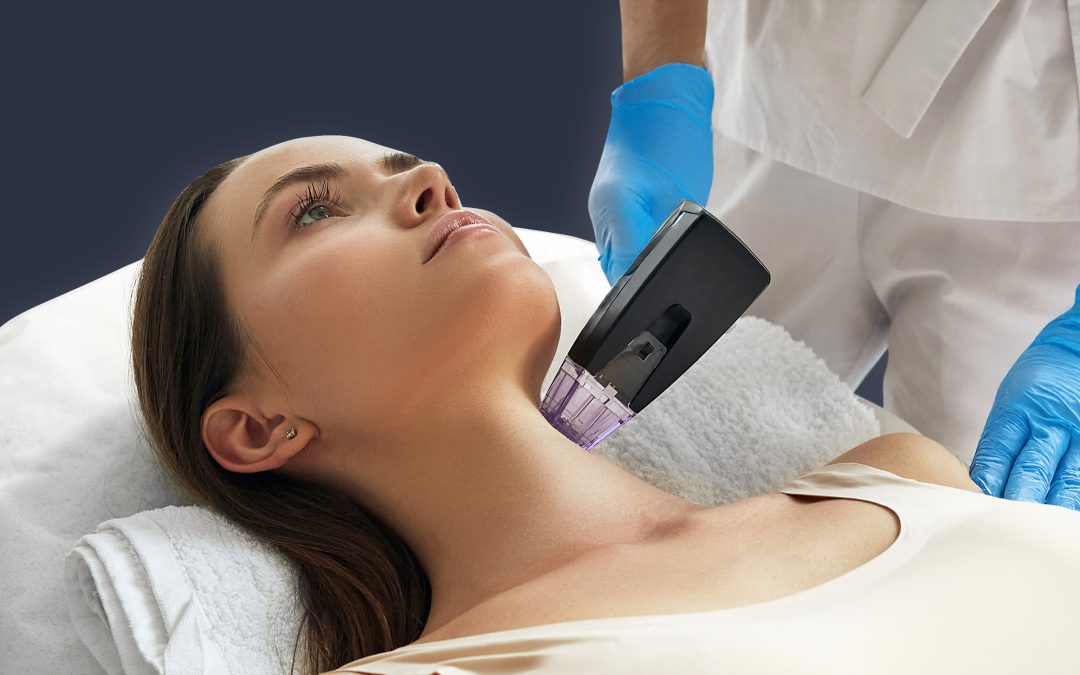 Radiofrecuencia: Preguntas frecuentes