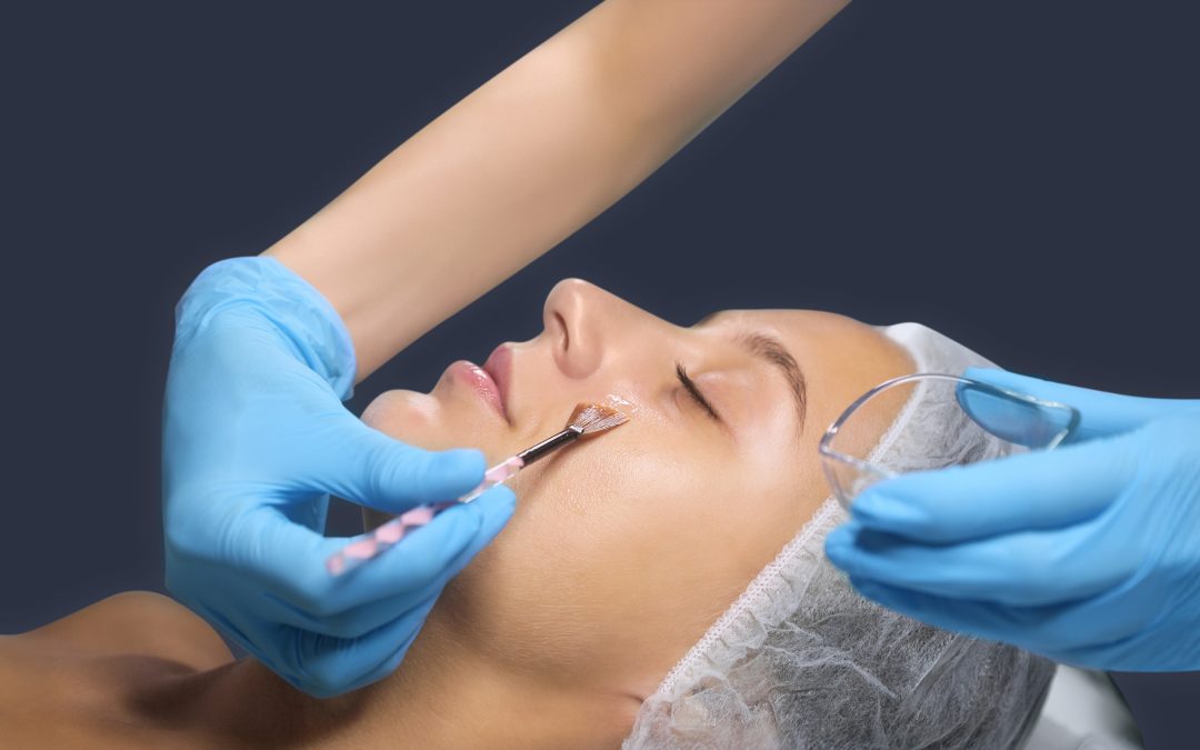 Peeling Químico: Preguntas frecuentes