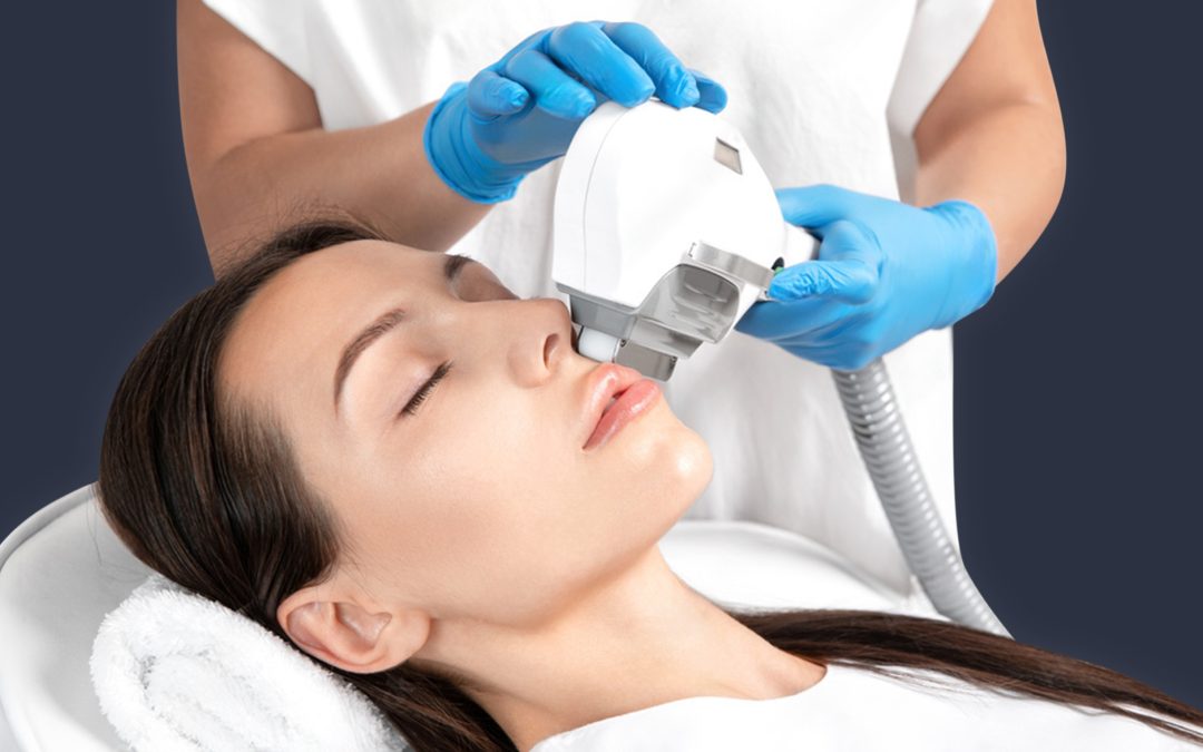 IPL: Preguntas frecuentes